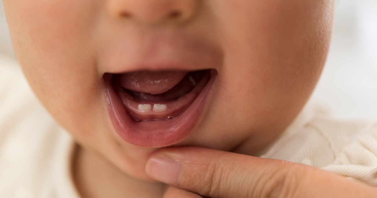 乳児の出っ歯